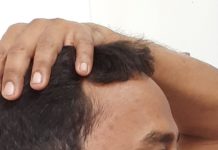 need to know about best Cervicogenic Headache DARADIA THE PAIN CLINIC FOR HEADACHE TREATMENT