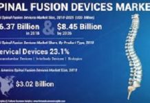 Spinal Devices Market By Services, Solution, Application, Business Analysis, Currents Trends, Statistics, And Investment Opportunities To 2024 – 2030