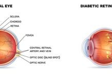 Retinal Disorders Treatment Market To Cross Valuation Of Us$ 19 Bn By 2030