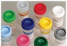 Formalin Vials Market Growth to Remain Steady during the Forecast Period 2019 – 2027