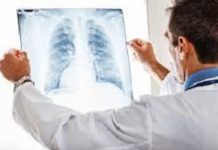 X-Ray Market To Reach Valuation Of ~Us$ 17.4 Bn By 2027