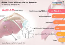 Global Tumor Ablation Market: Global Industry Analysis, Size, Share, Growth, Current Demand, and forecast 2017-2024
