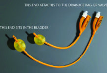 Urinary Catheters Market Trending Attributes Creating Positive Impact On The Industry Shares 2025