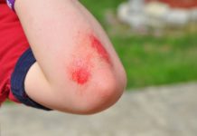 scrape