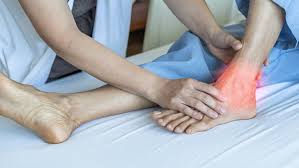 Achilles tendon pain Physical therapy Philadelphia