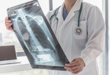 X-ray Market Development Trends & Competitive Analysis by Leading Industry Players