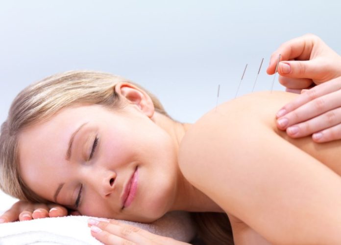 Benefits of Acupuncture