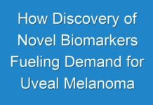 How Discovery of Novel Biomarkers Fueling Demand for Uveal Melanoma Treatment?
